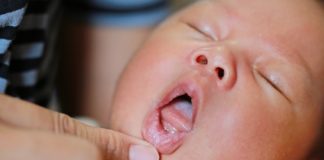 Белый язык у новорожденного при грудном вскармливании